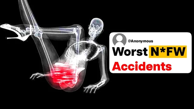 Thumbnail for the UnderSparked video: Medical Professionals, What Is The Worst N*FW Accident You've Seen?