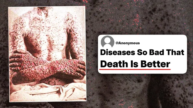 Thumbnail for the UnderSparked video: What Diseases Are So Bad That Even Doctors Say Death Would Be Better?